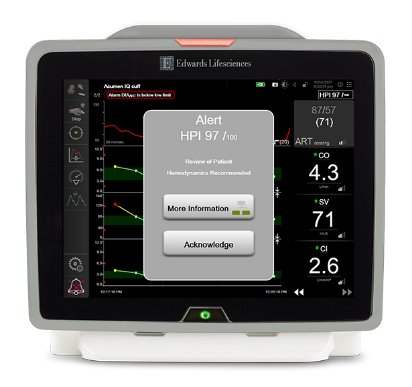 A HIO pode ser reduzida