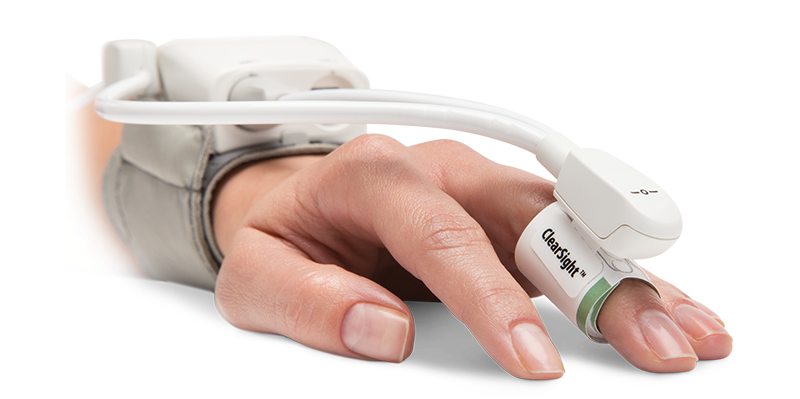 Sistema FloTrac | Edwards Lifesciences