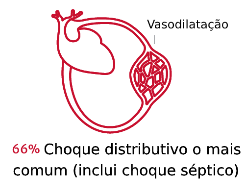 Os tipos de choque s&atilde;o importantes 1