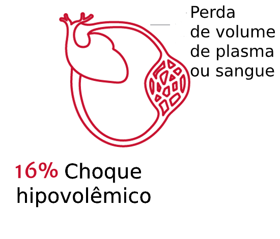 Os tipos de choque s&atilde;o importantes 2