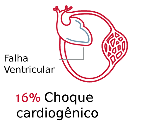 Os tipos de choque s&atilde;o importantes 3