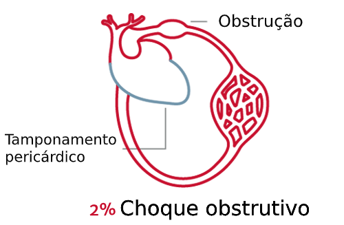 Os tipos de choque s&atilde;o importantes 4