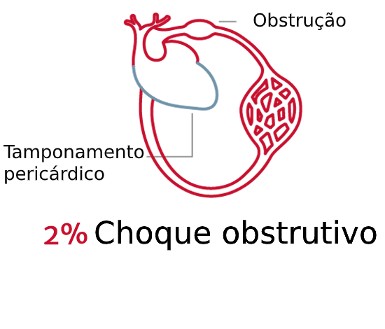 Os tipos de choque s&atilde;o importantes 4