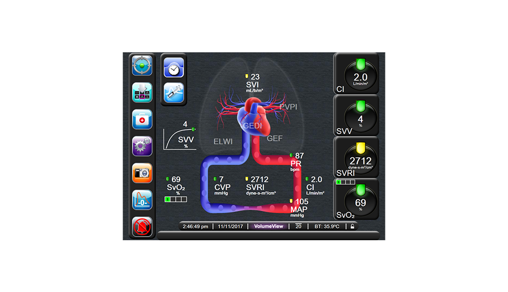 VolumeView – Ausgabeparameter
