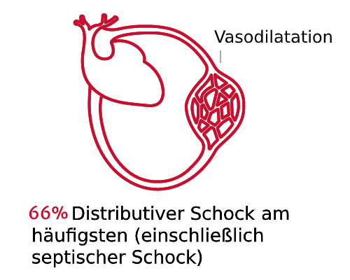 Schockarten sind von Bedeutung 1