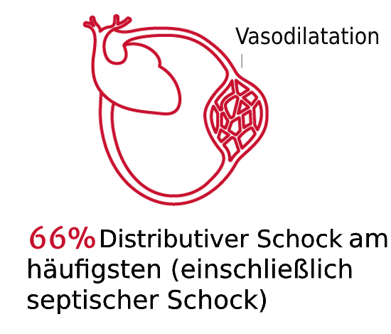 Schockarten sind von Bedeutung 1