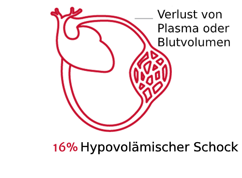 Schockarten sind von Bedeutung 2