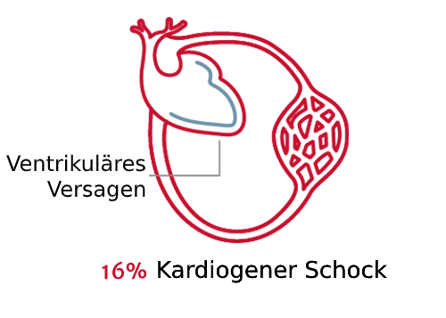 Schockarten sind von Bedeutung 3