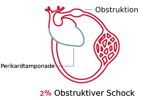 Schockarten sind von Bedeutung 4