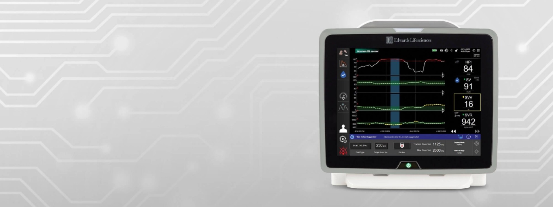 Software Acumen Assisted Fluid Management | Edwards Lifesciences