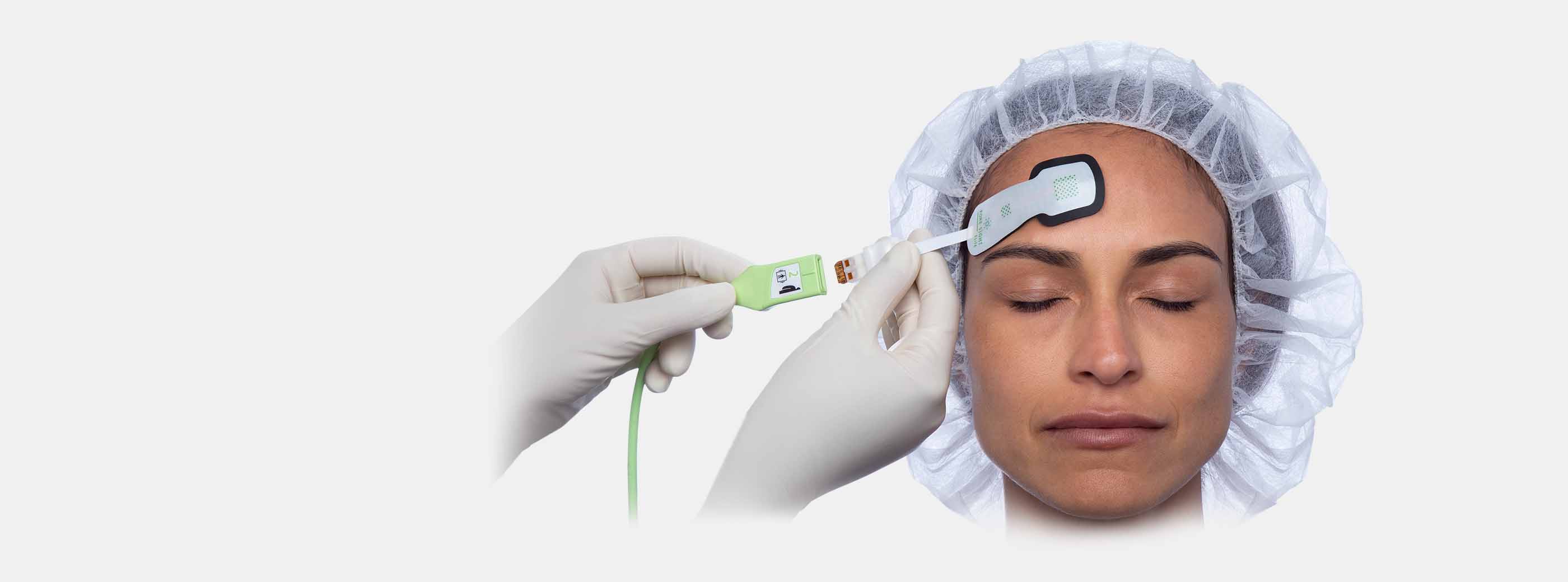 Foresight O2 Sensor Sensor de oximetría tisular ForeSight | Edwards Lifesciences