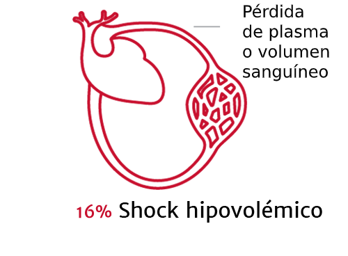 La importancia de los tipos de shock 2