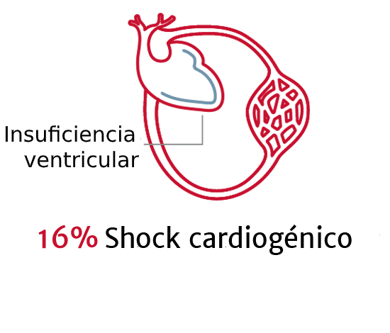 La importancia de los tipos de shock 3