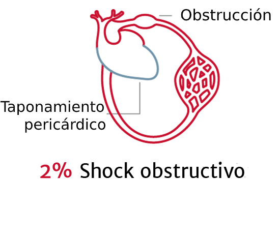 La importancia de los tipos de shock 4