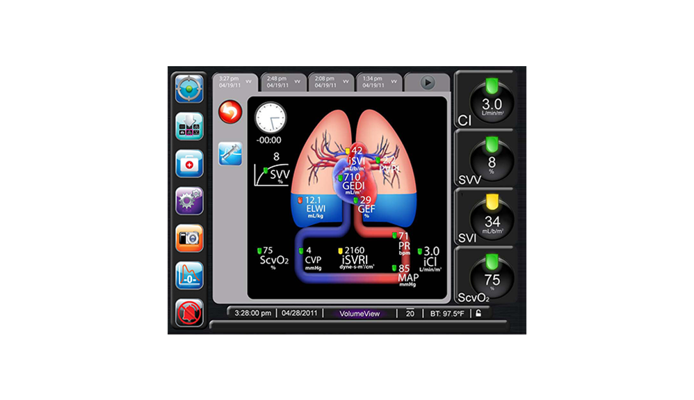 Parametri di uscita del set VolumeView
