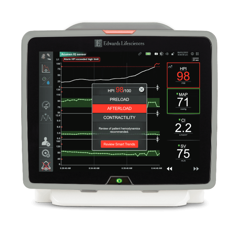Edwards Monitor Piattaforma di monitoraggio avanzato HemoSphere | Edwards Lifesciences