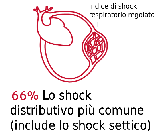 L'importanza del tipo di shock 1