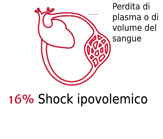 L'importanza del tipo di shock 2
