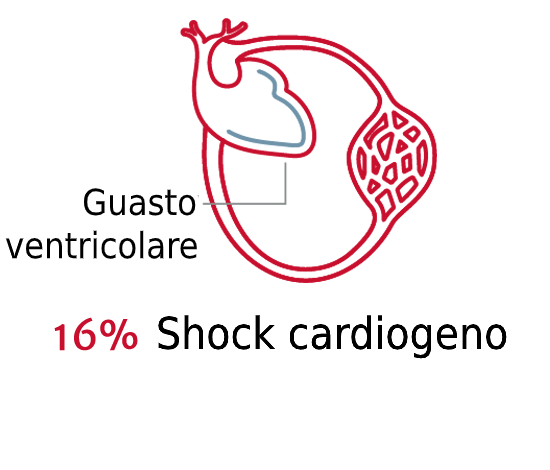 L'importanza del tipo di shock 3
