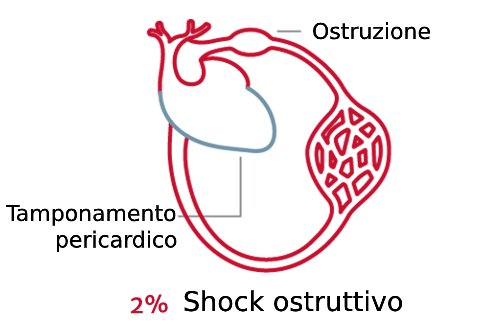 L'importanza del tipo di shock 4